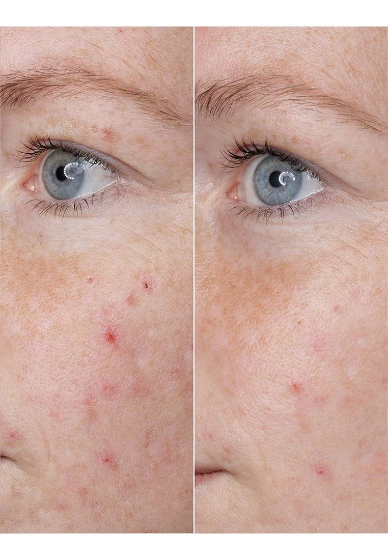 BABOR BABOR HYALURONIC ACID AMPOULE - Serum Bestseller